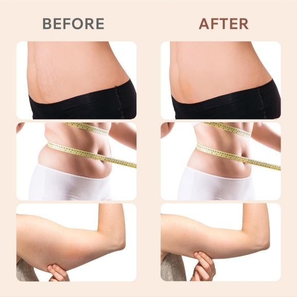 Depsoul Cellulite Massager, Upgraded Body Sculpting Machine 4 in 1 Wireless Cell - Picture 4 of 7